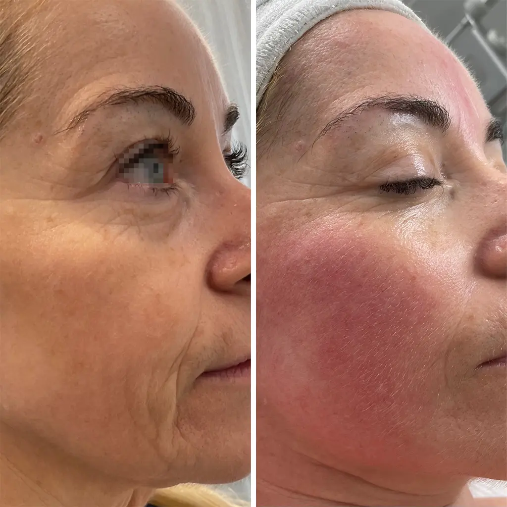 age attraction arckezeles purebeautyhouse