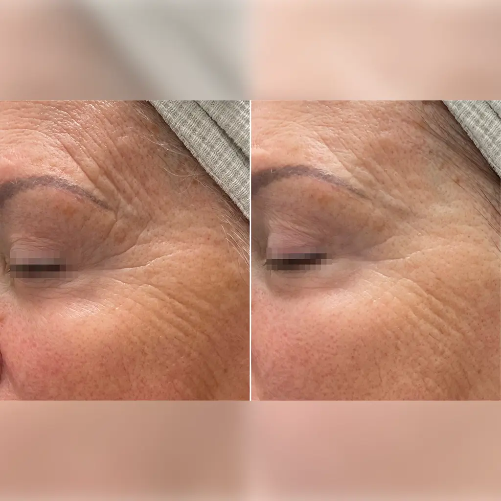 age attraction beforeafter pure beauty