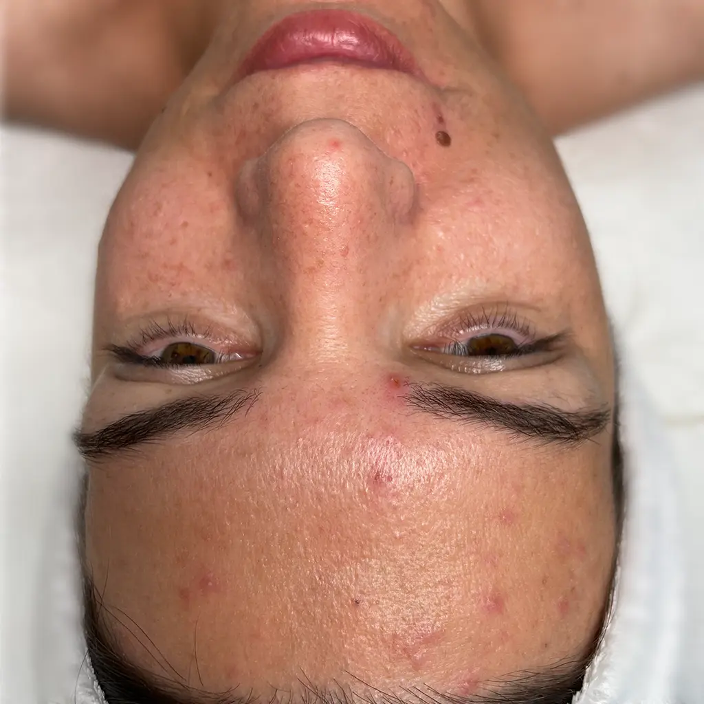 carbon peeling elott pure