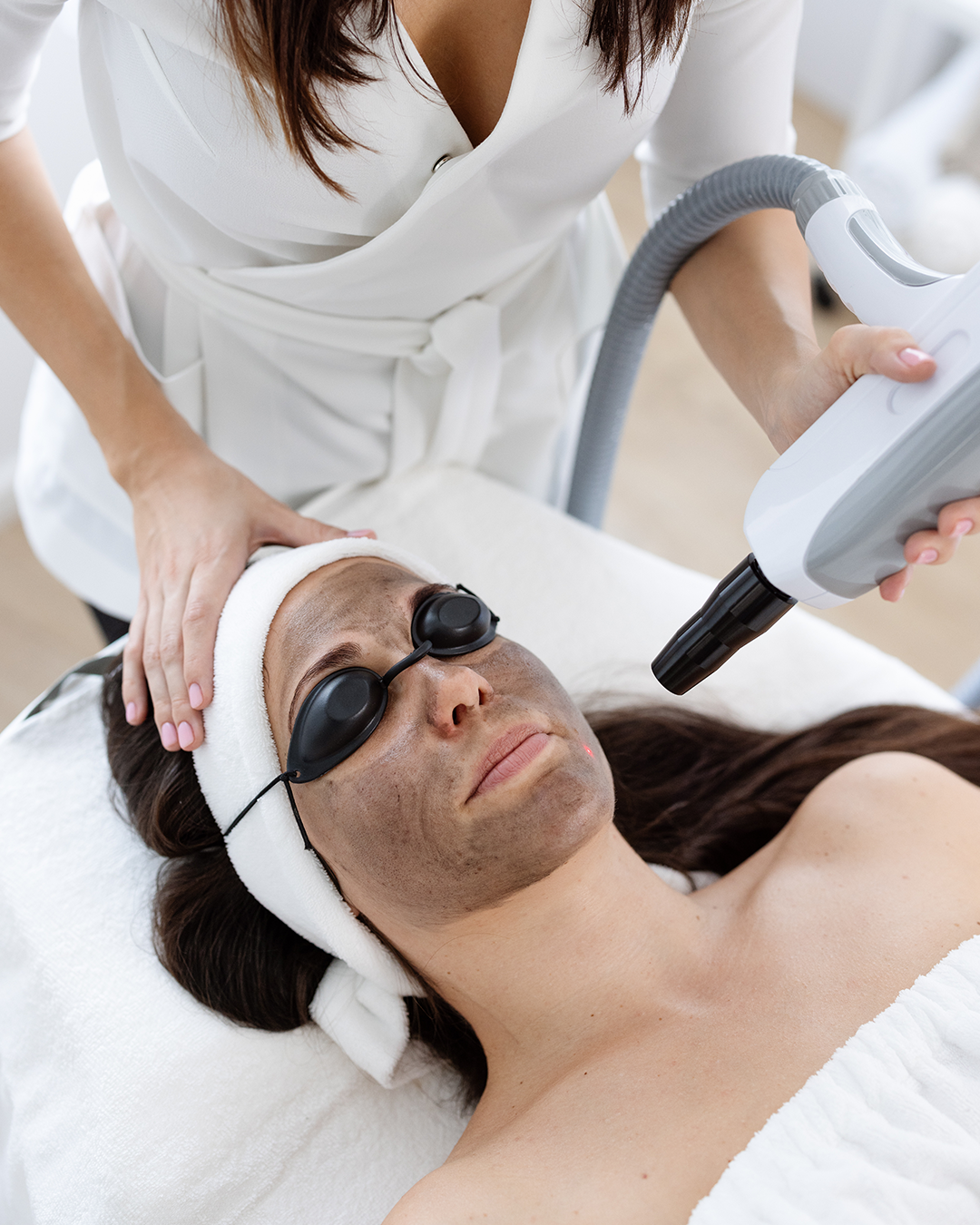 Carbon peeling arckezelés