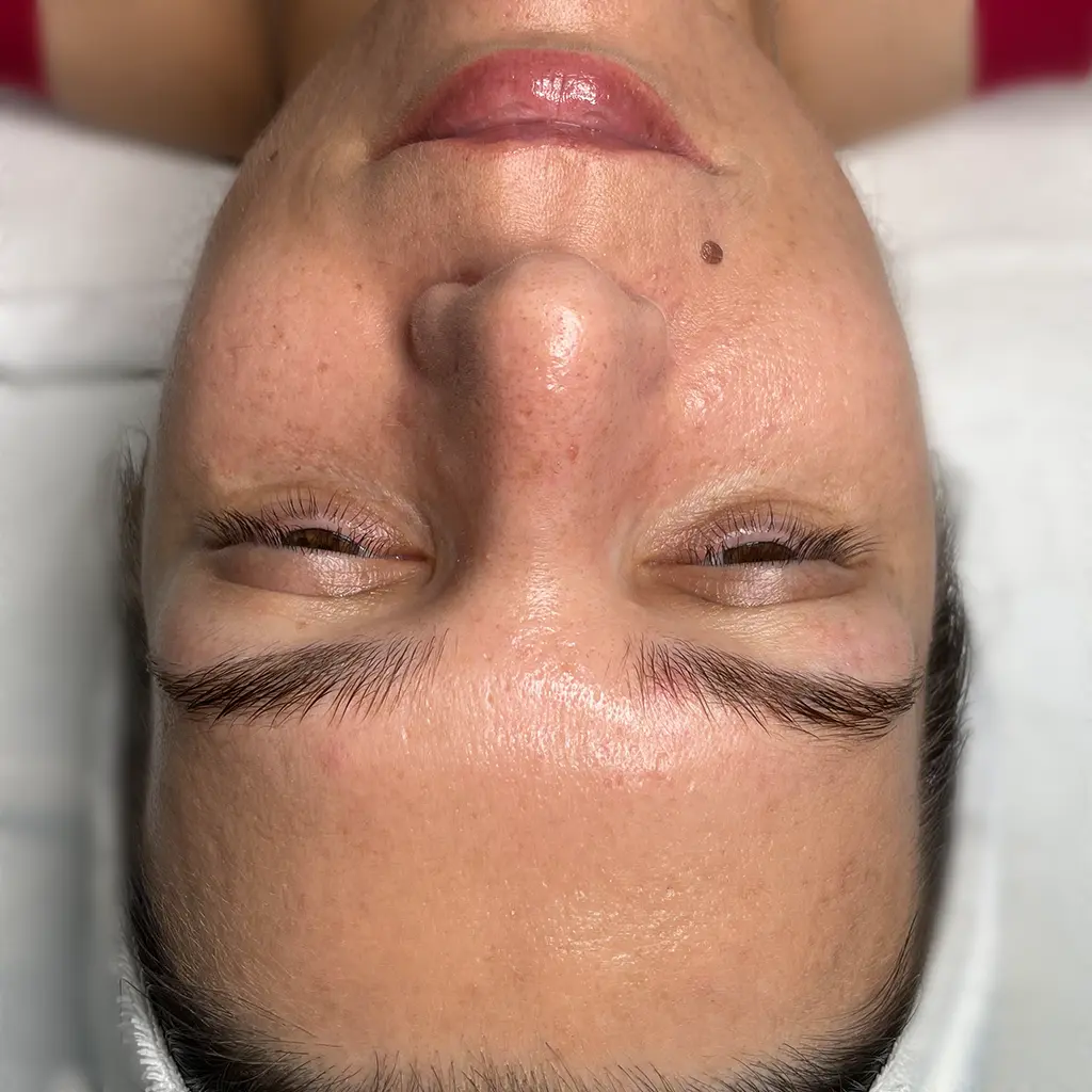 carbon peeling utan pure