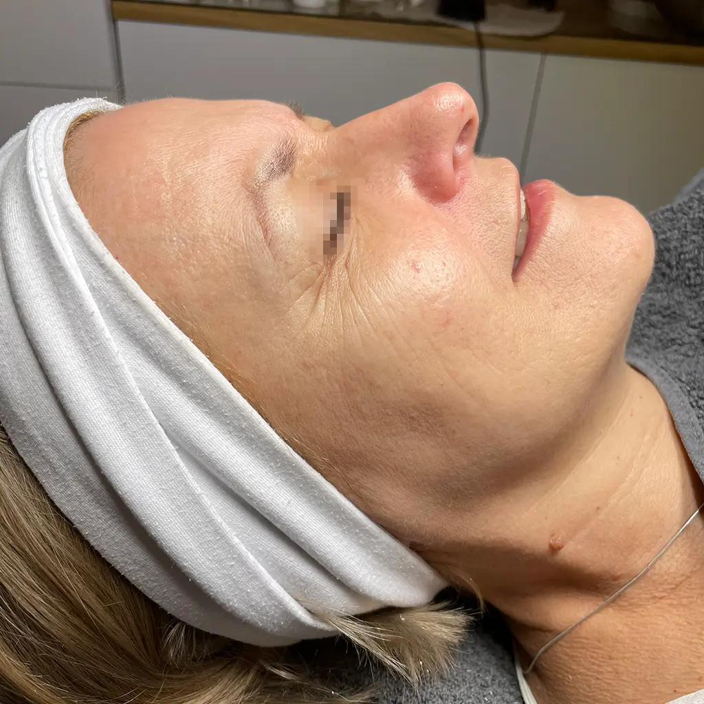 genosys dermafix arckezeles purebeautyhouse