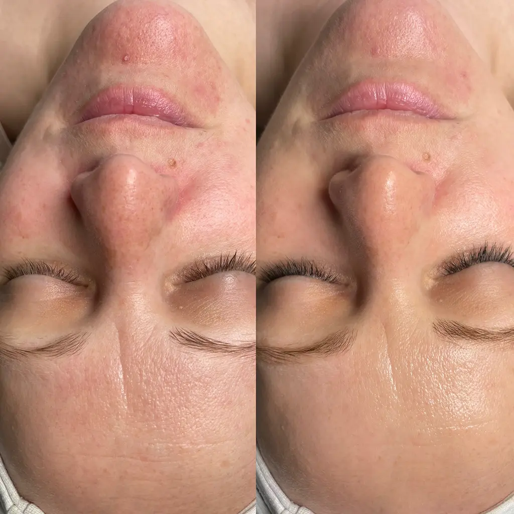 hydra touch h2 purebeautyhouse