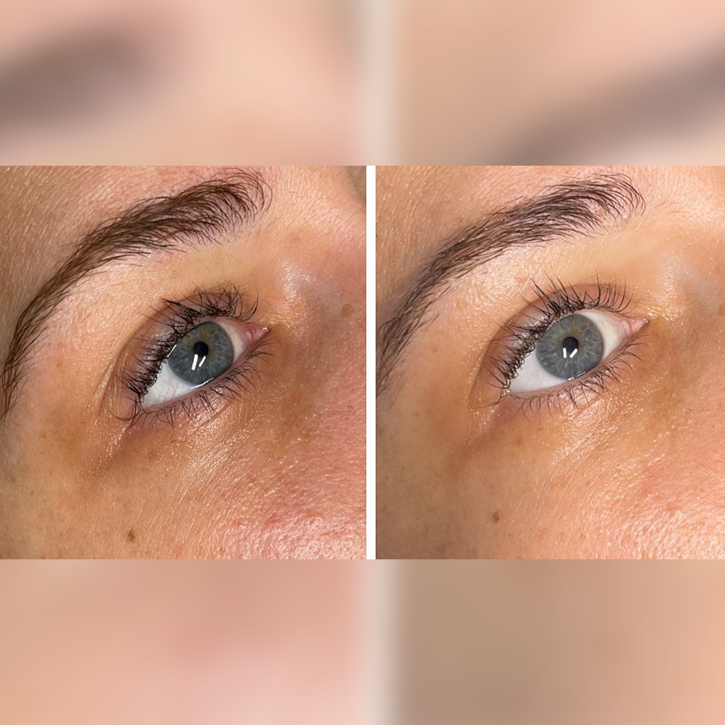 nctf kezeles pure beauty