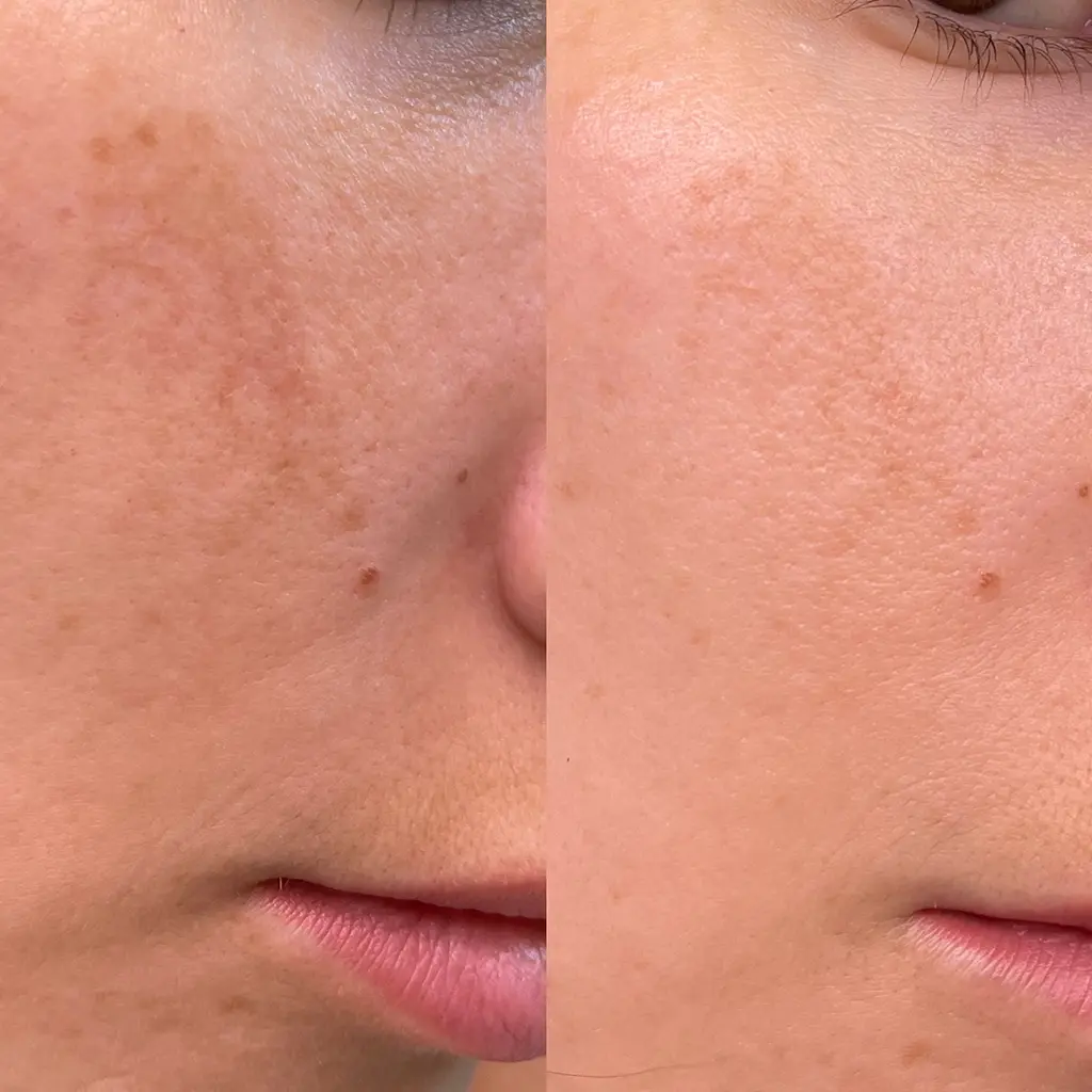 power shape arckezeles purebeautyhouse