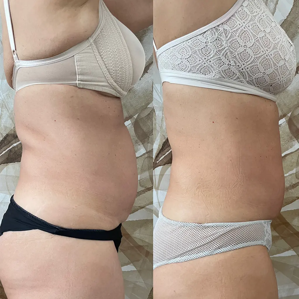 power shape testkezeles utan pure beautyhouse kozmetika