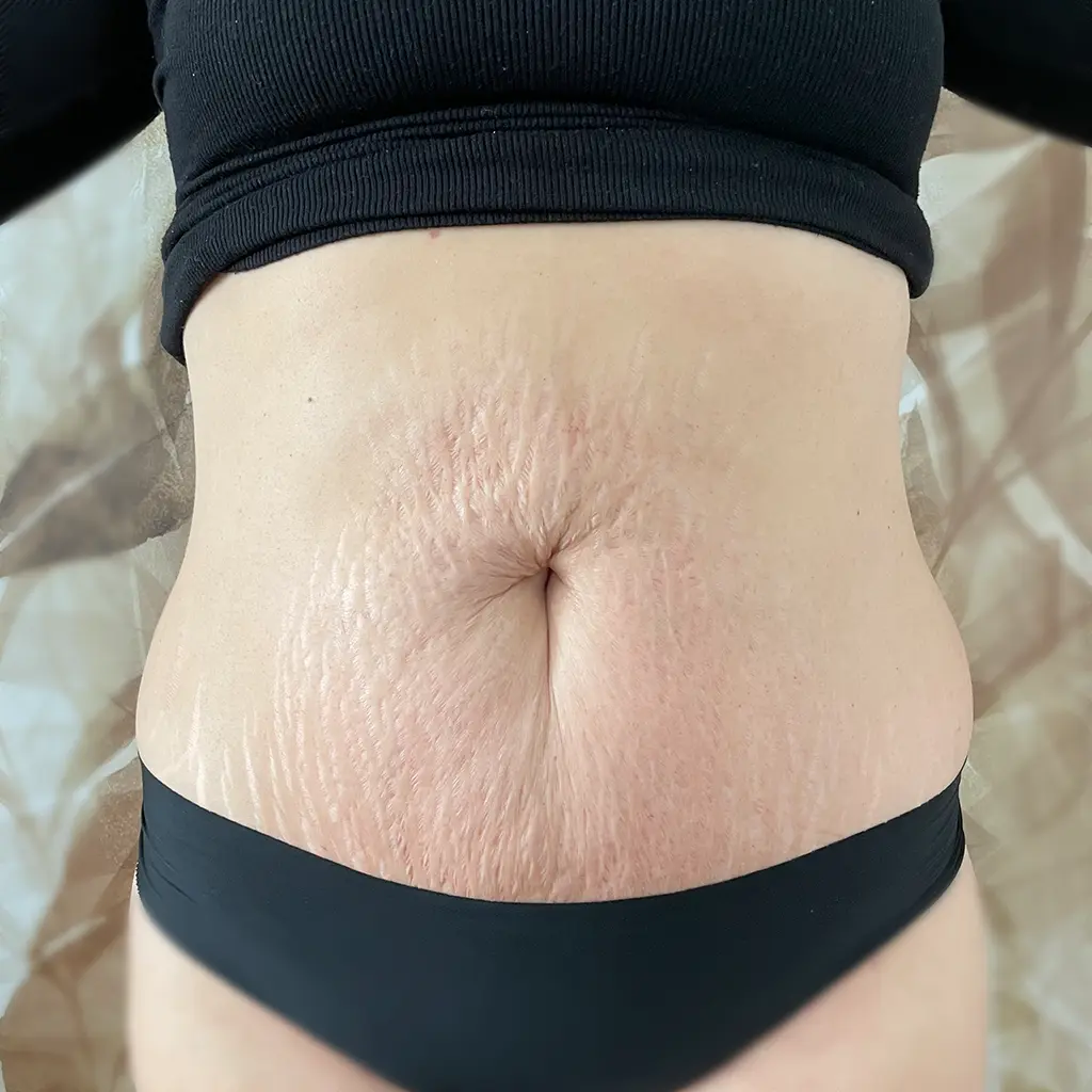 power shape utan3 pure
