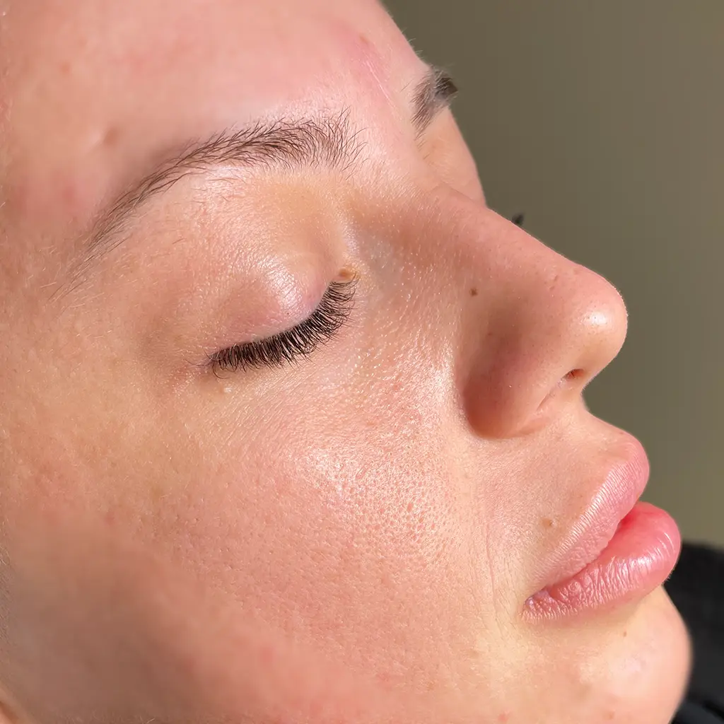 Szemöldök laminálás és szempilla lifting 16 szempilla lifting2 pure